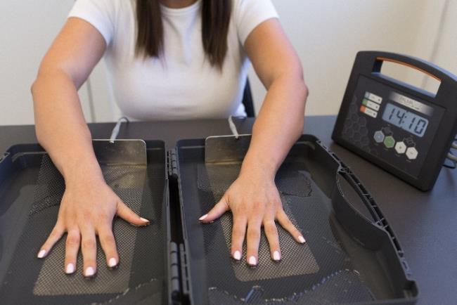 טיפול באמצעות פלמה דריי להזעה יתר בכפות הידיים